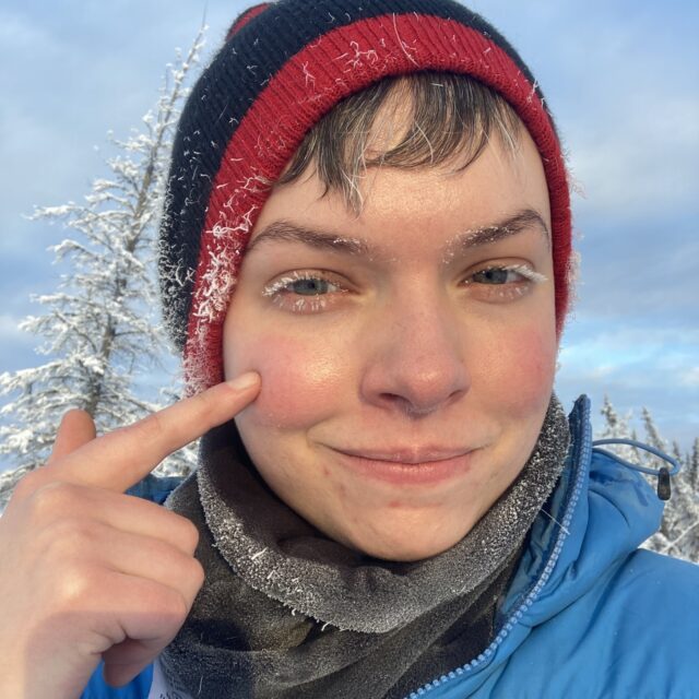 Santana, wearing a blue and red toque, grey turtleneck, and bright blue winter jacket, points to her rosy cheeks and icy eyelashes.